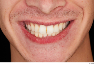 Johnny Reed teeth 0001.jpg